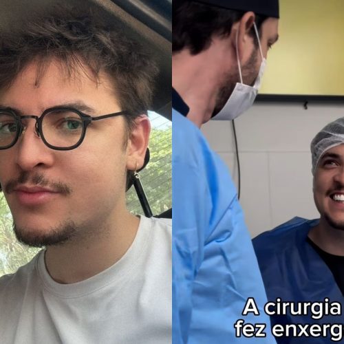 Gah Bernardes realiza cirurgia refrativa para corrigir miopia